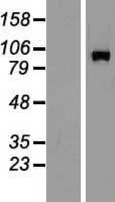 Western Blot: DGK-beta Overexpression Lysate [NBP2-09799]