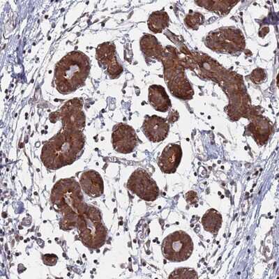 Immunohistochemistry-Paraffin: DGK-delta Antibody [NBP2-13917]