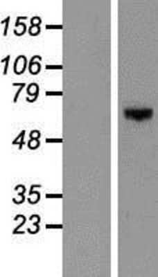 Western Blot: DGK-epsilon Overexpression Lysate [NBP2-07970]