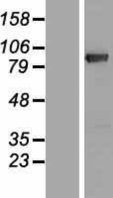 Western Blot: DGK-gamma Overexpression Lysate [NBP2-08408]