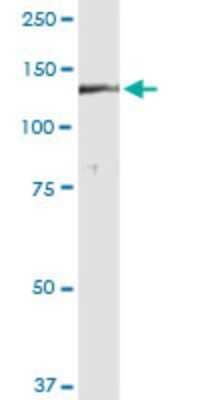 Western Blot: DGKH Antibody (2G11) [H00160851-M01]