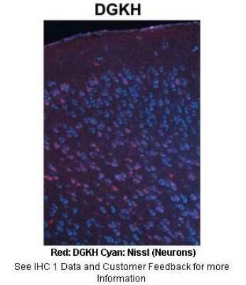 Immunohistochemistry: DGKH Antibody [NBP2-87267]