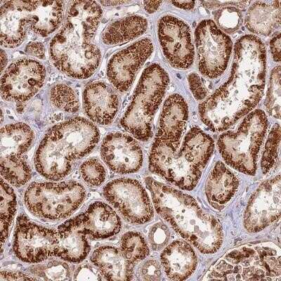 Immunohistochemistry-Paraffin: DGKH Antibody [NBP1-85228]