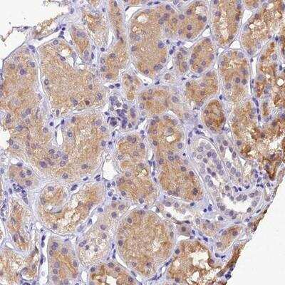 Immunohistochemistry-Paraffin: DGKH Antibody [NBP1-85229]