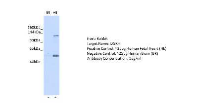 Western Blot: DGKH Antibody [NBP2-87267]