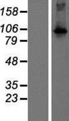 Western Blot: DGK-theta Overexpression Lysate [NBP2-08216]