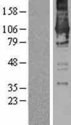 Western Blot: DGK-zeta Overexpression Lysate [NBL1-09855]