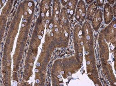 Immunohistochemistry-Paraffin: DHCR7 Antibody [NBP3-12940]