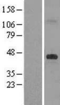 Western Blot: DHCR7 Overexpression Lysate [NBP2-10201]