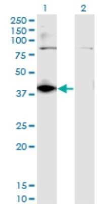 Western Blot: DHDH Antibody (3A11) [H00027294-M03]