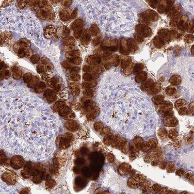 Immunohistochemistry-Paraffin: DHDH Antibody [NBP1-91831]