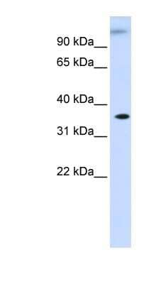 Western Blot: DHDH Antibody [NBP1-56950]