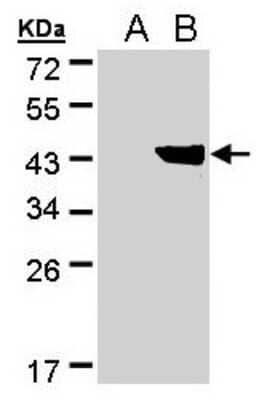 Western Blot: DHDH Antibody [NBP2-16158]