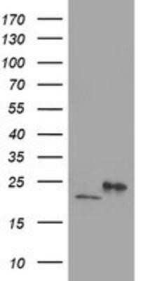 Western Blot: DHFRL1 Antibody (OTI1E2)Azide and BSA Free [NBP2-72459]