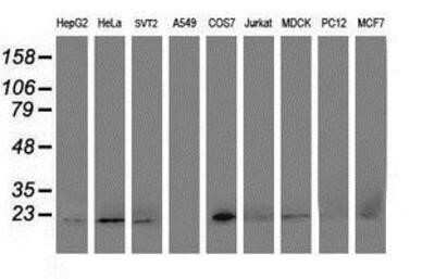 Western Blot: DHFRL1 Antibody (OTI1E2) [NBP2-01019]