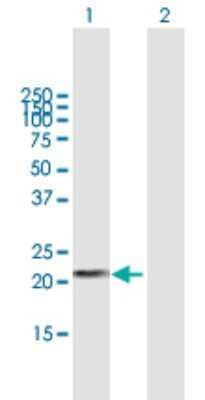 Western Blot: DHFRL1 Antibody [H00200895-B01P]