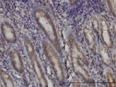 Immunohistochemistry-Paraffin: DHODH Antibody (6E1) [H00001723-M01]