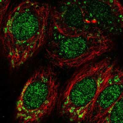 Immunocytochemistry/ Immunofluorescence: DHODH Antibody [NBP1-86097]
