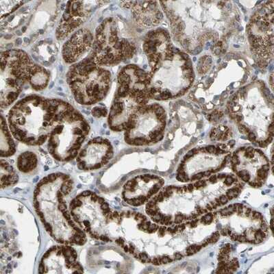 Immunohistochemistry-Paraffin: DHODH Antibody [NBP1-86097]