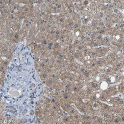 Immunohistochemistry-Paraffin: DHODH Antibody [NBP1-86097]