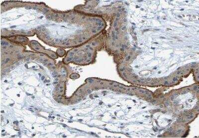Immunohistochemistry-Paraffin: DHODH Antibody [NBP1-86097]