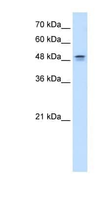 Western Blot: DHODH Antibody [NBP1-59584]