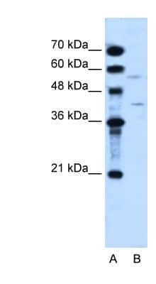 Western Blot: DHODH Antibody [NBP1-59591]