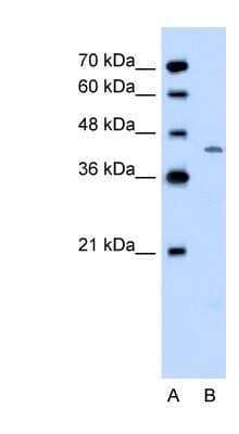 Western Blot: DHODH Antibody [NBP1-59593]