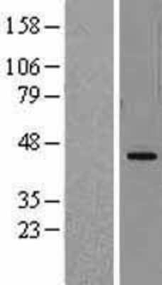 Western Blot: DHODH Overexpression Lysate [NBL1-09863]