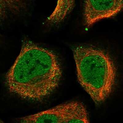 Immunocytochemistry/ Immunofluorescence: DHPS Antibody [NBP1-82648]