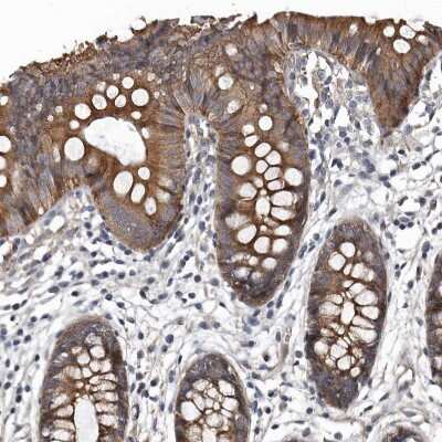 Immunohistochemistry-Paraffin: DHPS Antibody [NBP1-82648]