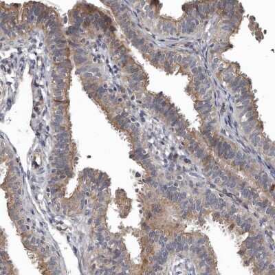 Immunohistochemistry-Paraffin: DHPS Antibody [NBP1-82648]