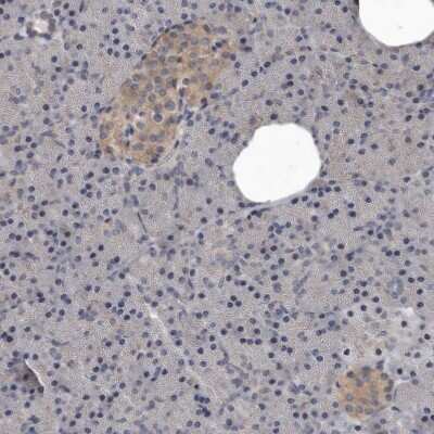 Immunohistochemistry-Paraffin: DHPS Antibody [NBP1-82648]