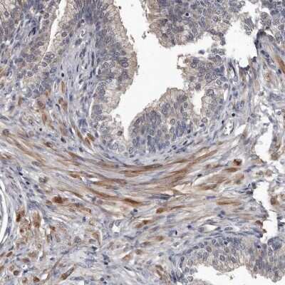 Immunohistochemistry-Paraffin: DHPS Antibody [NBP1-82648]