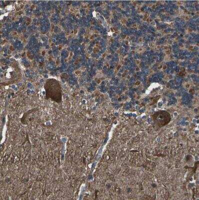 Immunohistochemistry-Paraffin: DHPS Antibody [NBP1-82649]