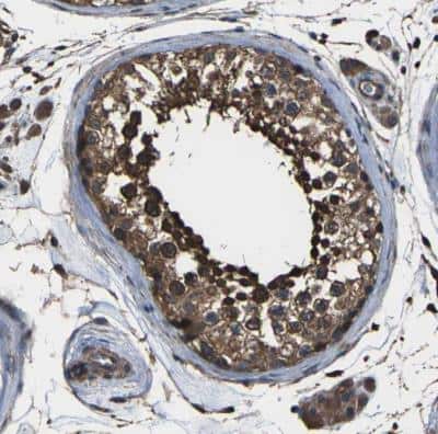 Immunohistochemistry-Paraffin: DHPS Antibody [NBP1-82649]
