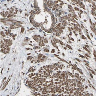 Immunohistochemistry-Paraffin: DHPS Antibody [NBP1-82649]