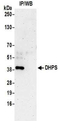 Immunoprecipitation: DHPS Antibody [NBP2-32256]