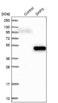 Western Blot: DHPS Antibody [NBP1-82648]