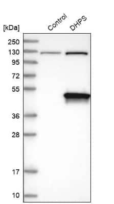 Western Blot: DHPS Antibody [NBP1-82649]