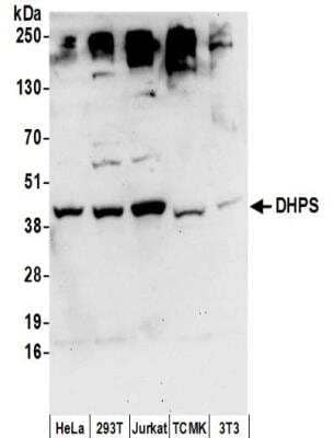 Western Blot: DHPS Antibody [NBP2-32256]