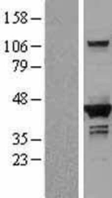 Western Blot: DHPS Overexpression Lysate [NBL1-09864]