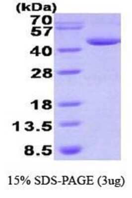 SDS-PAGE: Recombinant Human DHPS His Protein [NBP1-41227]