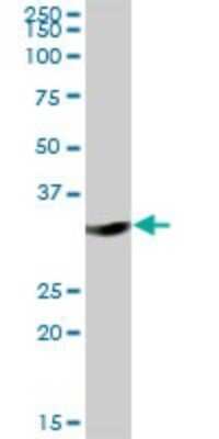 Western Blot: DHRS1 Antibody [H00115817-B01P]