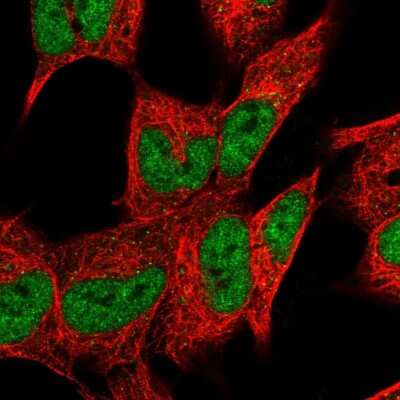 Immunocytochemistry/ Immunofluorescence: DHRS12 Antibody [NBP2-58115]