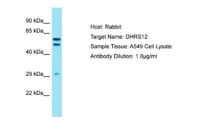 Western Blot: DHRS12 Antibody [NBP2-84667]