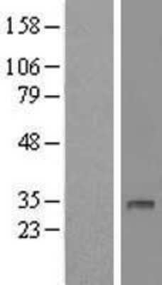 Western Blot: DHRS12 Overexpression Lysate [NBL1-09866]