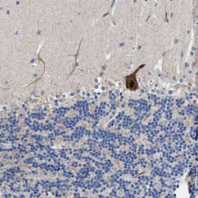 Immunohistochemistry-Paraffin: DHRS13 Antibody [NBP1-81163]