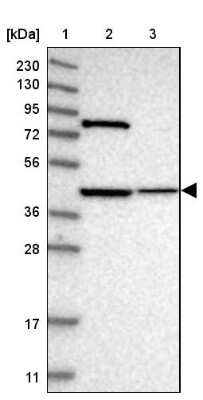 Western Blot: DHRS13 Antibody [NBP1-81163]