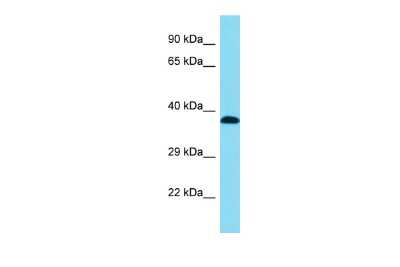 Western Blot: DHRS13 Antibody [NBP2-82847]